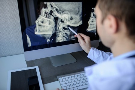 Healthcare professional looking at radiology image - Credit - Cucurudza - iStock.jpg